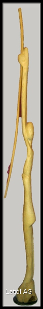 Femme au pilon